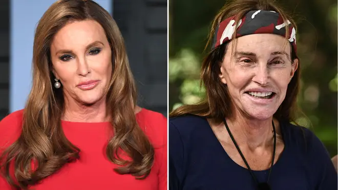 Caitlyn Jenner has obviously dropped weight as well