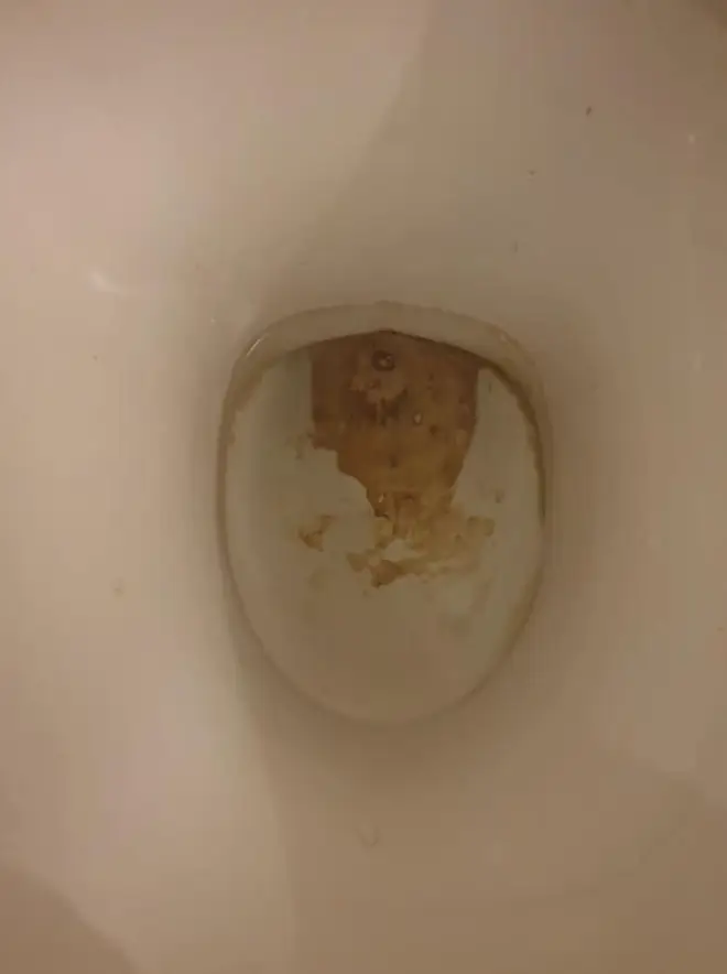 She shared an image of her dirty toilet bowl which was caked in limescale