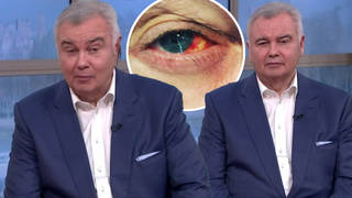 Eamonn Holmes turned to fans for advice after his eye became bloodshot