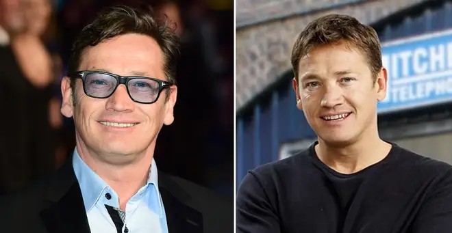 Sid Owen was hit in the head by a golf ball while on holiday in Thailand
