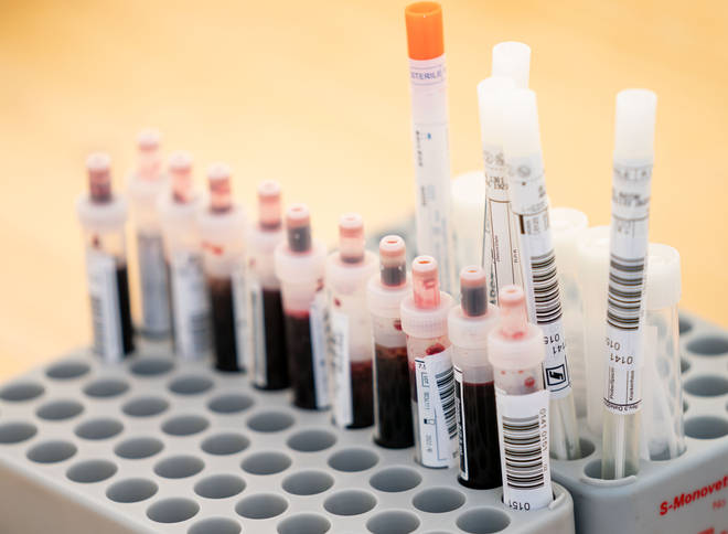 A blood test could detect different forms of cancer