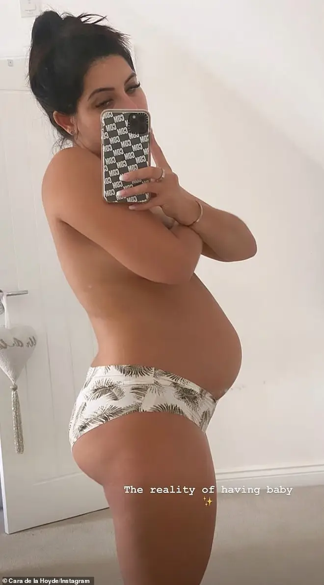 Cara De La Hoyde shared a photo of her post-baby body