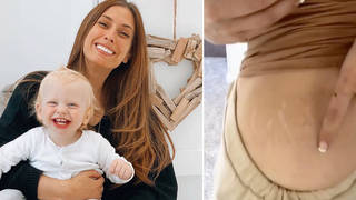 Stacey Solomon has shown off her stretch marks