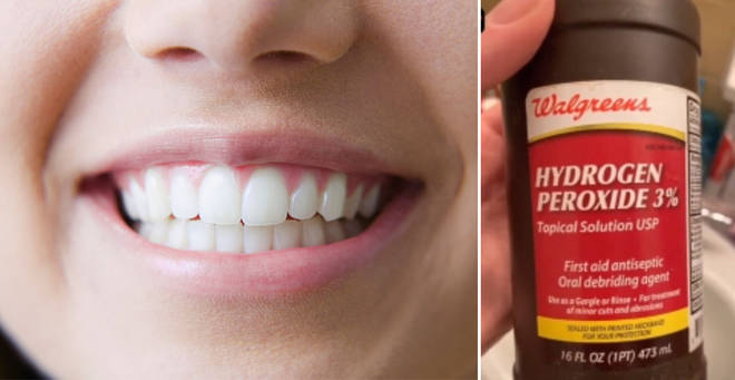 A dentist has warned against the TikTok trend (left: stock image)
