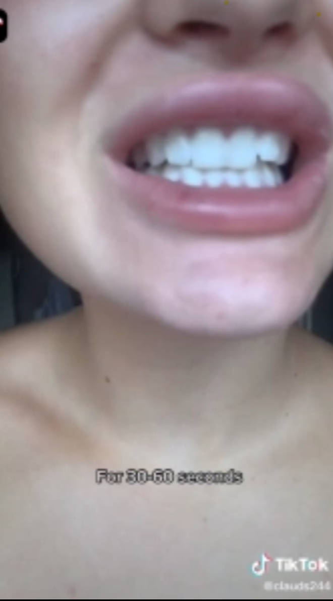 A number of TikTok users have been using hydrogen peroxide to bleach their teeth