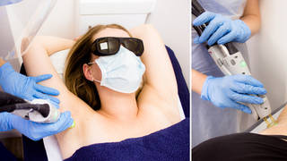 Tips when getting laser hair removal