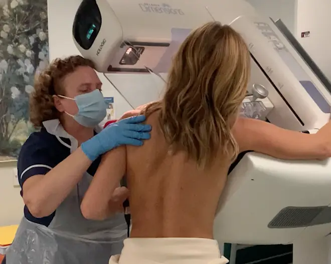 Amanda Holden has shared her mammogram