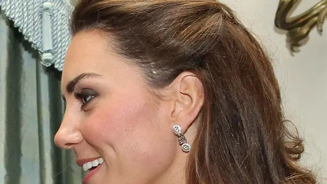 Kate's scar was spotted after she wore her hair in an up-do at a charity event in 2011