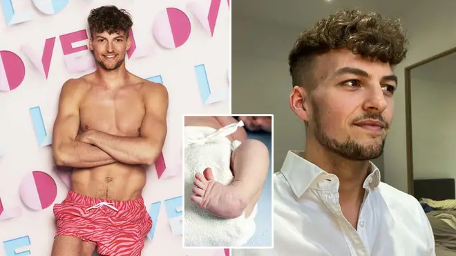 Hugo is Love Island's first disabled contestant