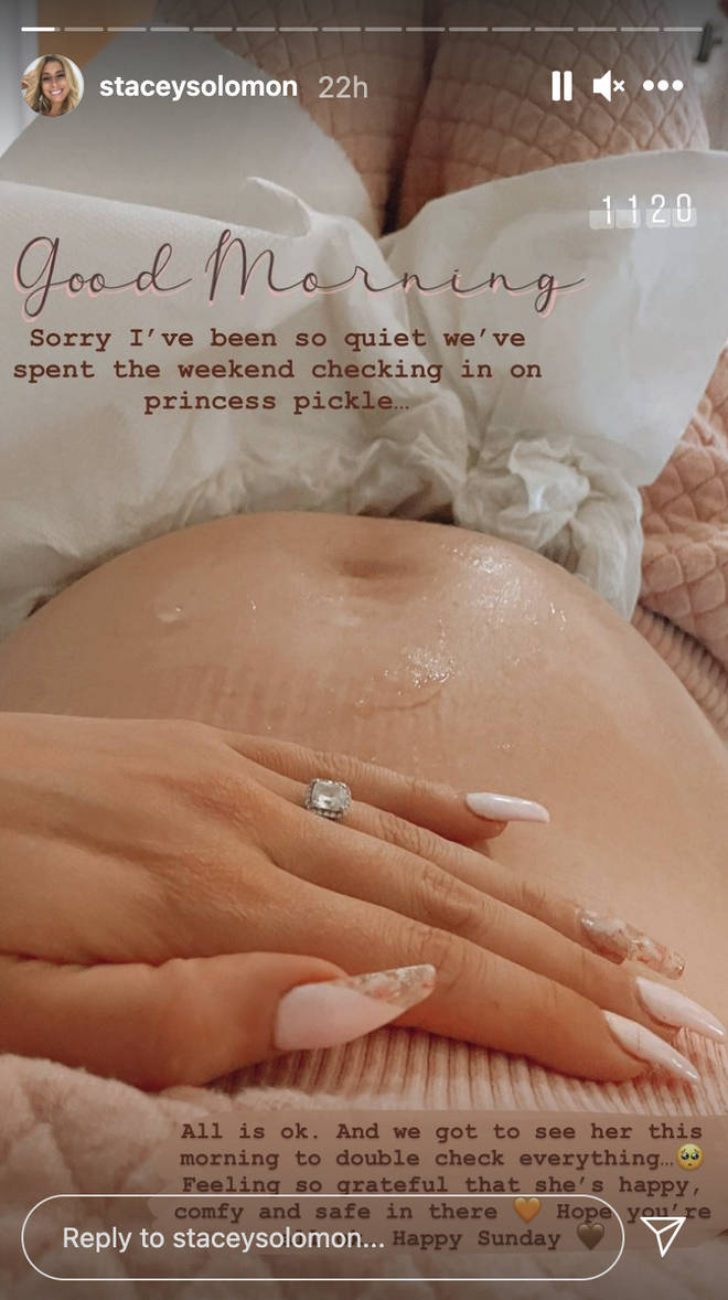 Stacey shared an update on her pregnancy to her Instagram stories