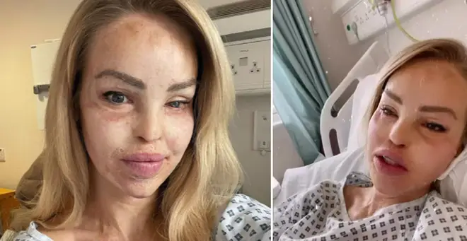 Katie Piper updated fans from hospital