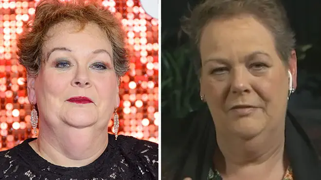 Anne - pictured left in January - has lost a stone while in the I'm A Celeb jungle