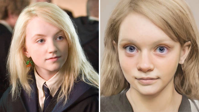In the Harry Potter books, Luna Lovegood is described as having 'pale eyebrows and protuberant eyes'