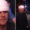 Ant McPartlin got a cut on his head while filming Britain's Got Talent
