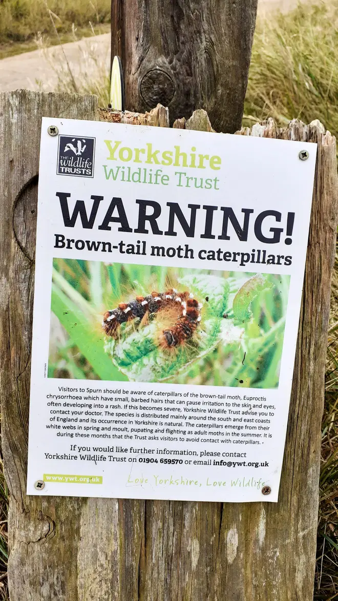The moths contain toxins which are released via contact or ingestion