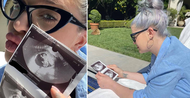 Kelly Osbourne is expecting her first baby