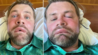 Westlife's Brian McFadden rushes to hospital after being stung by bee