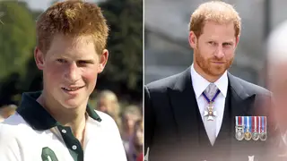 Prince Harry in 2005 compared to now
