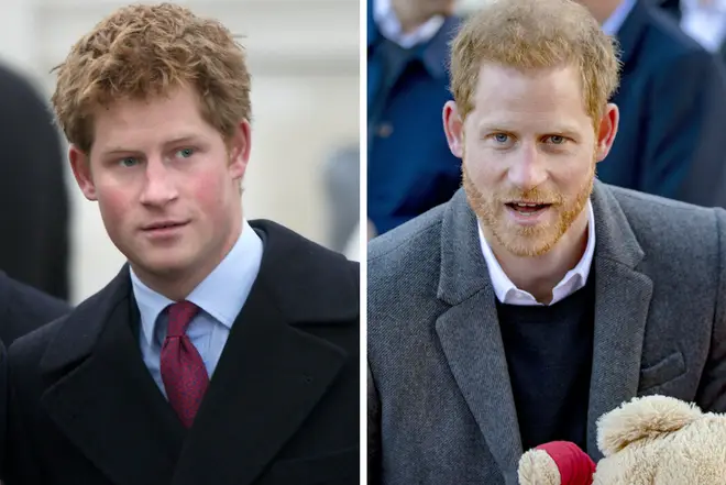Prince Harry before and after