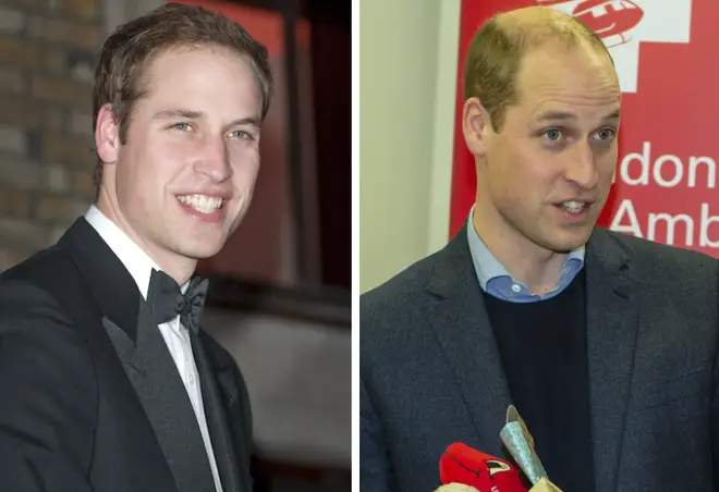 Prince William before and after