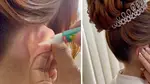 Bride super glues her ears back for wedding pictures