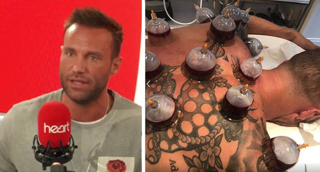 Calum Best has a lot of positive things to say about the controversial treatment