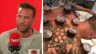 Calum Best has a lot of positive things to say about the controversial treatment