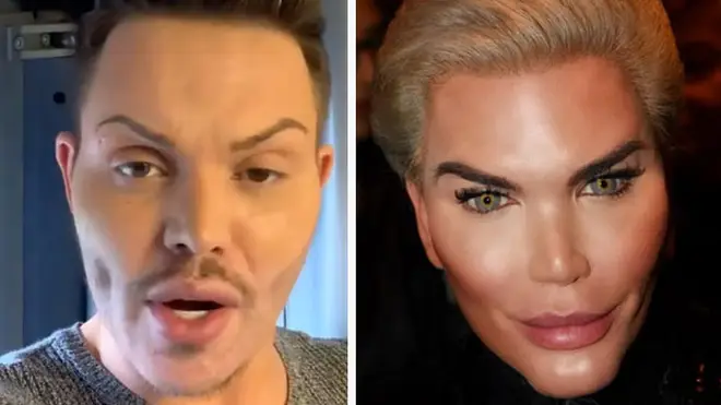 Bobby Norris has been compared to the Brazilian surgery addict