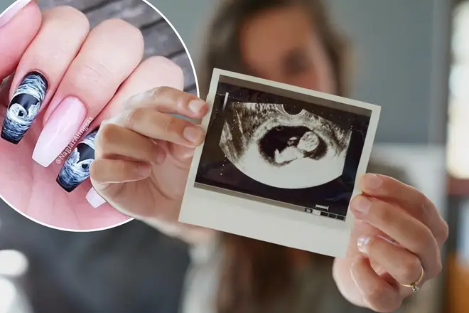 Mothers-to-be are getting their baby scans printed on their nails