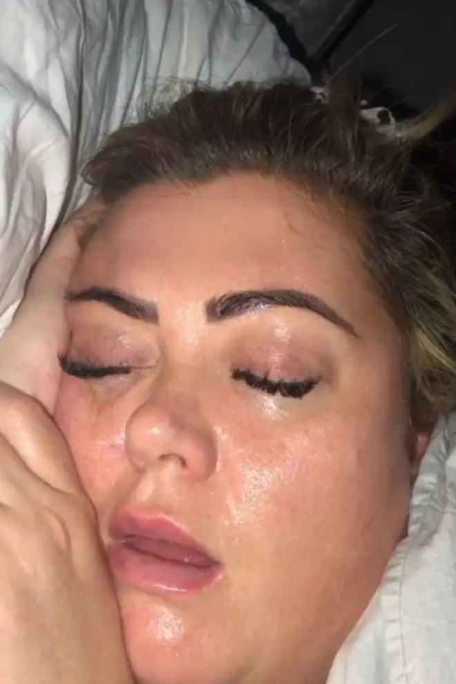 Arg posted an unflattering picture of Gemma on social media