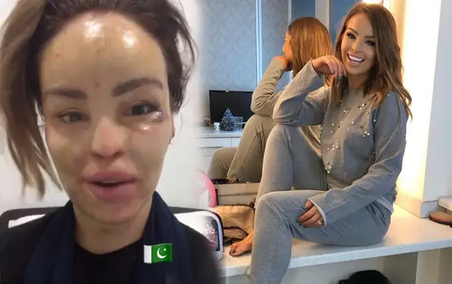 Katie Piper travels to Pakistan to see her regular surgeon Dr Muhammad Ali Jawad