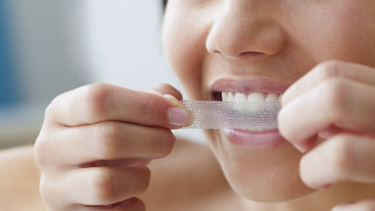 Teeth whitening kit instagram