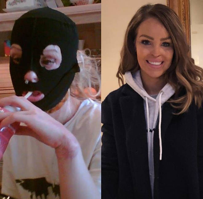 Katie Piper has said that surgeries have become "normal"