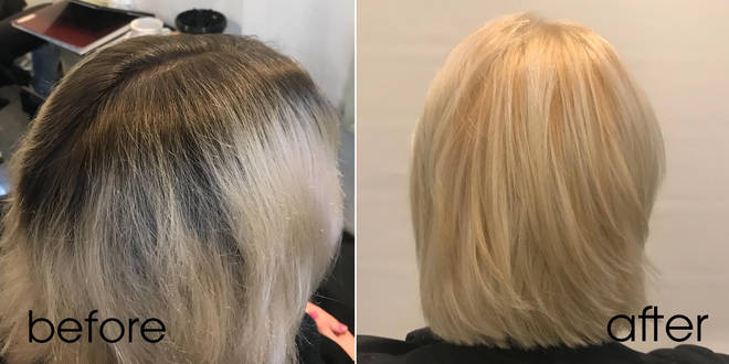 Here S Why You Should Never Bleach Your Roots At Home Heart