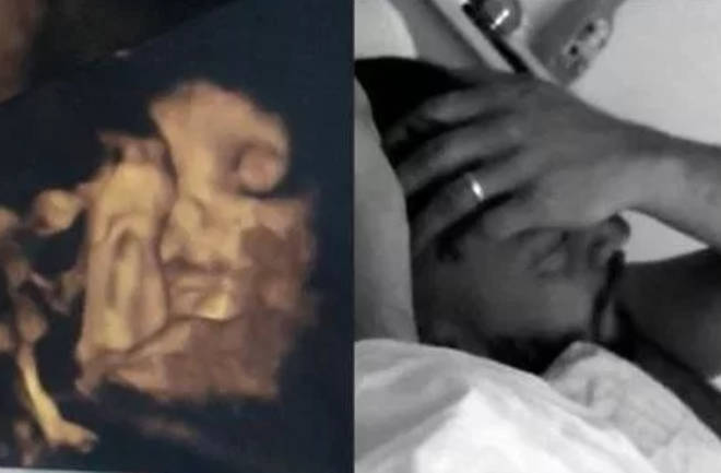 Mrs Hinch shared side-by-side pictures of her unborn baby and husband on Instagram