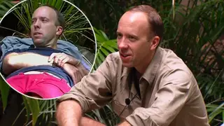 Matt Hancock opening up about his childhood on I'm A Celebrity