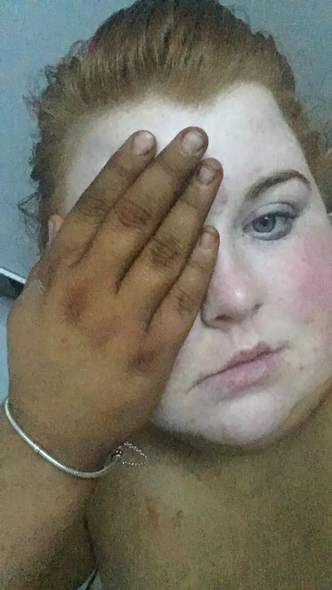 Her 'shocked' pictures she shared to social media made friends think she'd been kidnapped