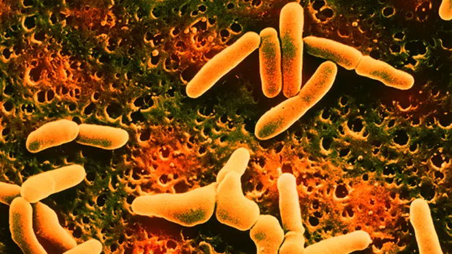 Listeria is a type of bacteria that can cause Listeriosis in humans