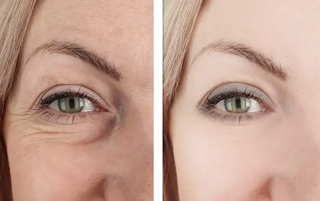 Getting rid of your eyeballs can make you seem more 'awake' and give a youthful appearance