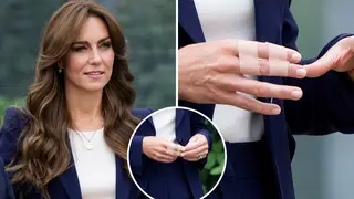 What happened to Kate Middleton's hand and why is she wearing a bandage?