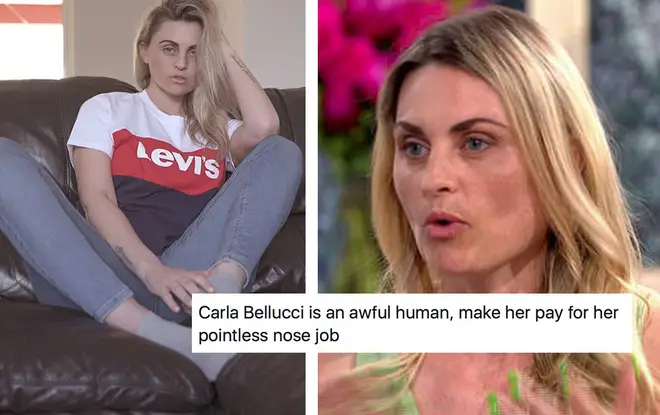 Carla spoke out about her decision to go ahead with the nose job