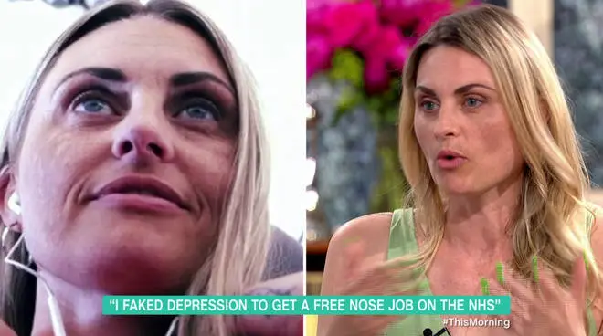 Carla has now received paid time off work after getting a free nose job