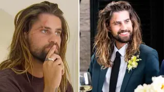 MAFS Australia's Stephen found it difficult to accept his facial scars