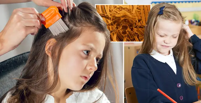 'Super nits' could be in your child's school