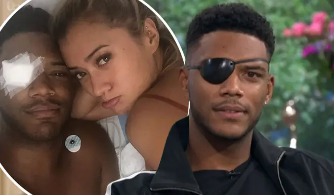 Theo Campbell lost sight in one of his eyes during a champagne party in Ibiza