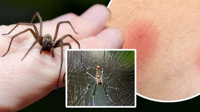 How To Recognise And Treat Spider Bites As They Enter Mating