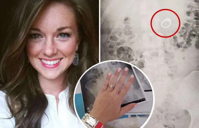 Jenna Evans accidentally swallowed her engagement ring after dreaming she needed to "eat it to protect it".
