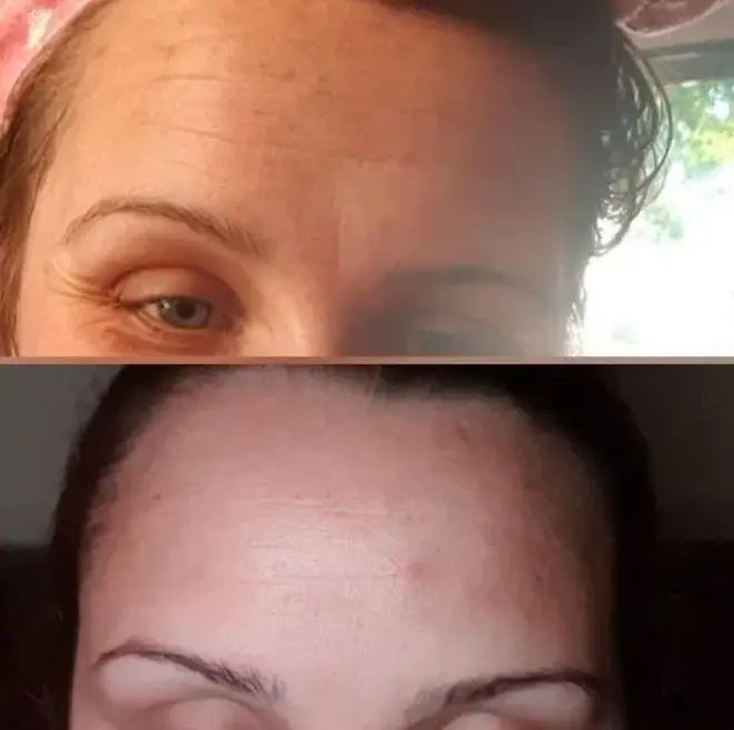 Kayleigh posted before and after pictures on the product page