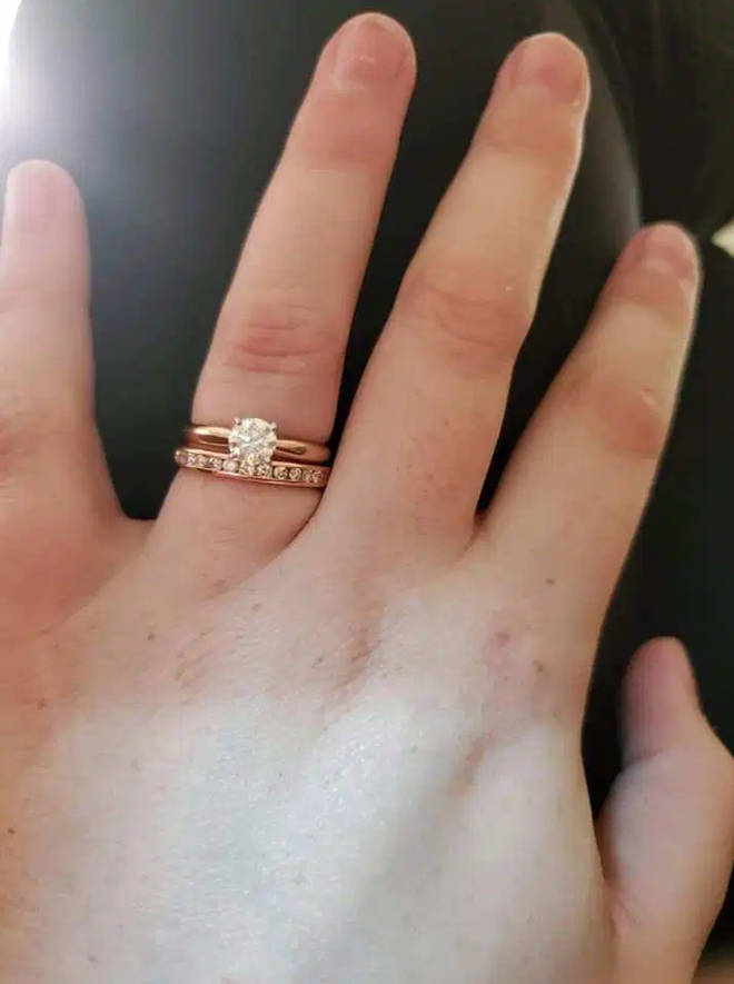 She posted the photos of her own ring on the wedding-shaming group