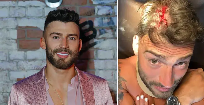 Jake Quickenden told his Instagram followers after his terrifying ordeal
